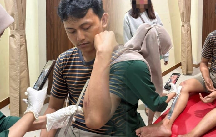 Sekretaris DPD Gerakan Mahasiswa Nasional Indonesia (GMNI) Sulawesi Barat, Yudi, dianiaya. (Foto: Int)